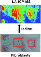 Graphical abstract: Iodine as an elemental marker for imaging of single cells and tissue sections by laser ablation inductively coupled plasma mass spectrometry