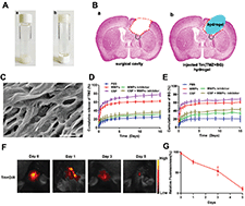 Graphical abstract: Injectable postoperative enzyme-responsive hydrogels for reversing temozolomide resistance and reducing local recurrence after glioma operation