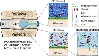 Graphical abstract: Tissue-mimetic hybrid bioadhesives for intervertebral disc repair