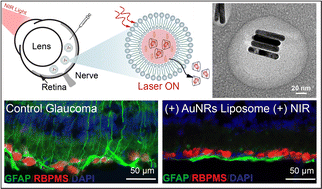 Graphical abstract: Near-infrared activated liposomes for neuroprotection in glaucoma