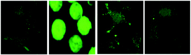 Graphical abstract: Protein kinase CK2 regulates metal toxicity in neuronal cells