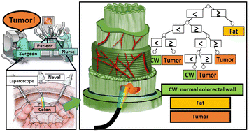 Graphical abstract: Diffuse reflectance spectroscopy for colorectal cancer surgical guidance: towards real-time tissue characterization and new biomarkers