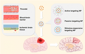 Graphical abstract: Recent advances in targeted nanoparticle drug delivery systems for ischaemic stroke