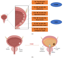 Graphical abstract: Hydrogel: a new material for intravesical drug delivery after bladder cancer surgery