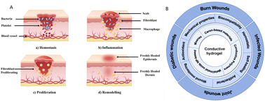 Graphical abstract: Progress in the application of conductive hydrogels in wound healing: a review