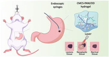 Graphical abstract: An injectable carboxymethyl chitosan–polyaniline/oxidized dextran triple-network hydrogel for long-term gastrointestinal tissue marking and photothermal tumor therapy