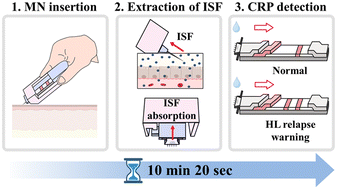 Graphical abstract: Development of a high-performance sliding microneedle-lateral flow immunoassay strip device for ultra-rapid point-of-care diagnosis
