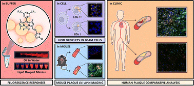Graphical abstract: BODIPY-based fluorescent probes distinguish the heterogeneity of lipid droplets in carotid and femoral atherosclerotic plaques