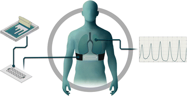 Graphical abstract: Screen-printed wearable sensors for continuous respiratory rate monitoring: fabrication, clinical evaluation, and point-of-care potential