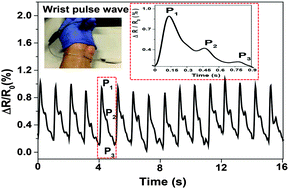 Graphical abstract: Volume-invariant ionic liquid microbands as highly durable wearable biomedical sensors