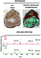 Graphical abstract: Rapid determination of the tumour stroma ratio in squamous cell carcinomas with desorption electrospray ionization mass spectrometry (DESI-MS): a proof-of-concept demonstration