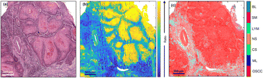 Graphical abstract: Metric-based analysis of FTIR data to discriminate tissue types in oral cancer