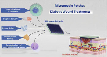 Graphical abstract: Microneedle patches: a new vantage point for diabetic wound treatments