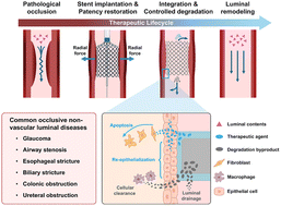 Graphical abstract: Recent advances in non-vascular stents for occlusive luminal disease treatment