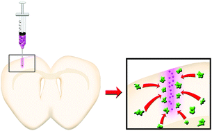 Graphical abstract: Spatiotemporal presentation of exogenous SDF-1 with PLGA nanoparticles modulates SDF-1/CXCR4 signaling axis in the rodent cortex