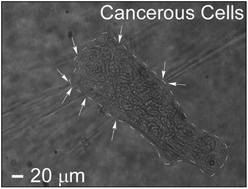 Graphical abstract: Rapid bladder cancer cell detection from clinical urine samples using an ultra-thin silicone membrane