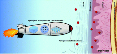 Graphical abstract: Latest on biomaterial-based therapies for topical treatment of psoriasis