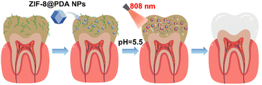 Graphical abstract: Dual-responsive polydopamine-embellished Zn-MOFs enabling synergistic photothermal and antibacterial metal ion therapy for oral biofilm eradication