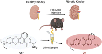 Graphical abstract: A NIR fluorescent probe for the detection of renal damage based on overrepresentation of alanine aminopeptidase enzyme