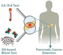 Graphical abstract: Nanoparticle-protein corona enhances accuracy of Ca-19.9-based pancreatic cancer classification