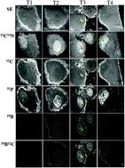 Graphical abstract: Microdistribution and quantification of the boron neutron capture therapy drug BPA in primary cell cultures of human glioblastoma tumour by NanoSIMS