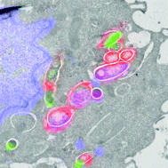 Graphical abstract: Metabolic labeling probes for interrogation of the host–pathogen interaction