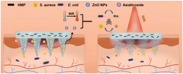 Graphical abstract: Multifunctional zwitterionic microneedle dressings for accelerated healing of chronic infected wounds in diabetic rat models