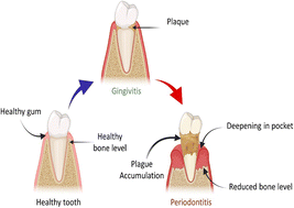 Graphical abstract: Applications and interventions of polymers and nanomaterials in alveolar bone regeneration and tooth dentistry