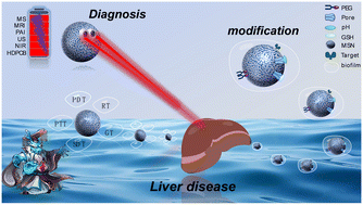 Graphical abstract: A promising mesoporous silica carrier material for the diagnosis and treatment of liver diseases: recent research advances