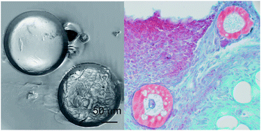 Graphical abstract: Sustained release of bupivacaine for post-surgical pain relief using core–shell microspheres