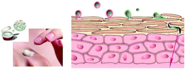 Graphical abstract: Vesicular systems for dermal and transdermal drug delivery