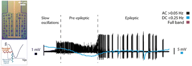 Graphical abstract: Recording physiological and pathological cortical activity and exogenous electric fields using graphene microtransistor arrays in vitro