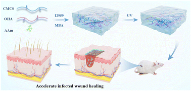 Graphical abstract: Extracellular matrix-inspired natural polymer-based composite hydrogel dressings for infected wound healing