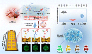 Graphical abstract: An AI-assisted multiplex fluorescence sensing platform for grading diagnosis of Alzheimer's disease