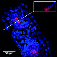 Graphical abstract: Disease-on-a-chip: mimicry of tumor growth in mammary ducts