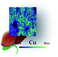 Graphical abstract: Laser ablation-inductively coupled plasma-mass spectrometry for quantitative mapping of the copper distribution in liver tissue sections from mice with liver disease induced by common bile duct ligation