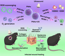 Graphical abstract: Infected wound repair with an ultrasound-enhanced nanozyme hydrogel scaffold