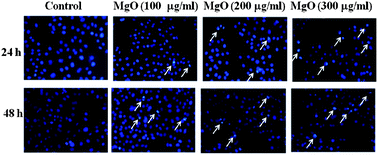 Mechanistic investigation on the toxicity of MgO nanoparticles toward ...