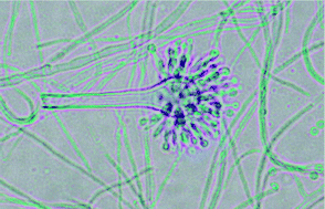 A new immunoassay to quantify fungal antigens from the indoor mould ...