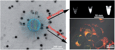 Theranostic nanoscale coordination polymers for magnetic resonance ...