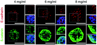 Increased Extracellular Matrix Density Disrupts E Cadherin B Catenin Complex In Gastric Cancer Cells Biomaterials Science Rsc Publishing