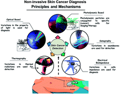 Skin cancer detection using non-invasive techniques - RSC Advances (RSC  Publishing)