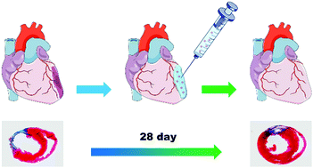 Sustained Release Of Bioactive Igf 1 From A Silk Fibroin Microsphere Based Injectable Alginate Hydrogel For The Treatment Of Myocardial Infarction Journal Of Materials Chemistry B Rsc Publishing