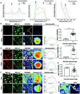 Pencitraan DO-SRS tentang dinamika metabolisme pada penuaan Drosophila