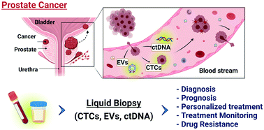 The Role Of Liquid Biopsies In Prostate Cancer Management Lab On A Chip Rsc Publishing