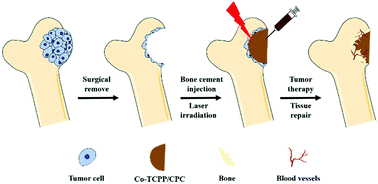 Bone cements for therapy and regeneration for minimally invasive