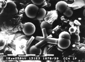 Graphical abstract: Crystallisation of calcium phosphates under constant conditions with a double diffusion set-up