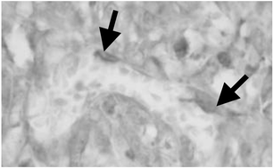Graphical abstract: Neutrophils as inflammatory and immune effectors in photodynamic therapy-treated mouse SCCVII tumours