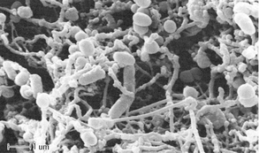 Graphical abstract: Lethal photosensitisation of oral bacteria and its potential application in the photodynamic therapy of oral infections