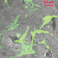 Graphical abstract: Injectable scaffolds for tissue regeneration